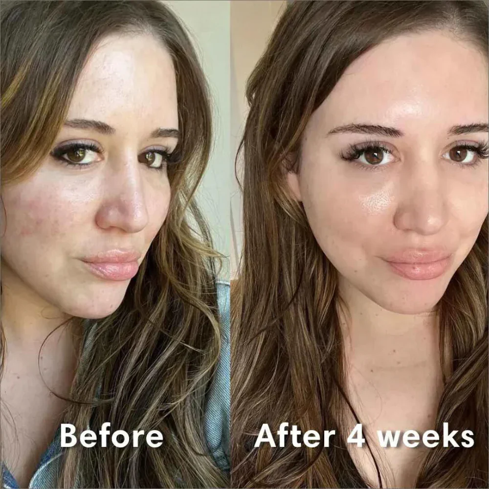 Bio-Collagen Bundle - Image 12