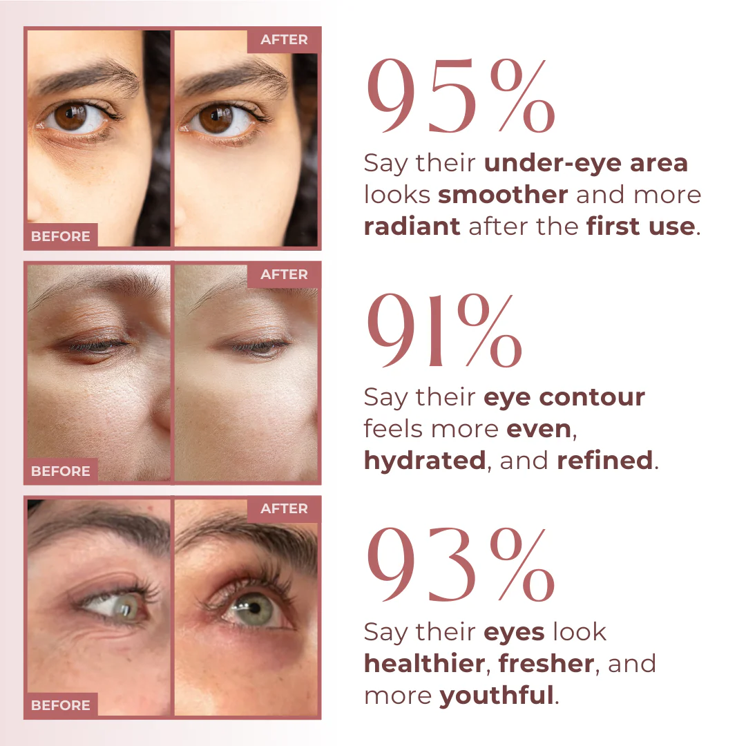 Bio-Collagen Eye Patches - Image 2