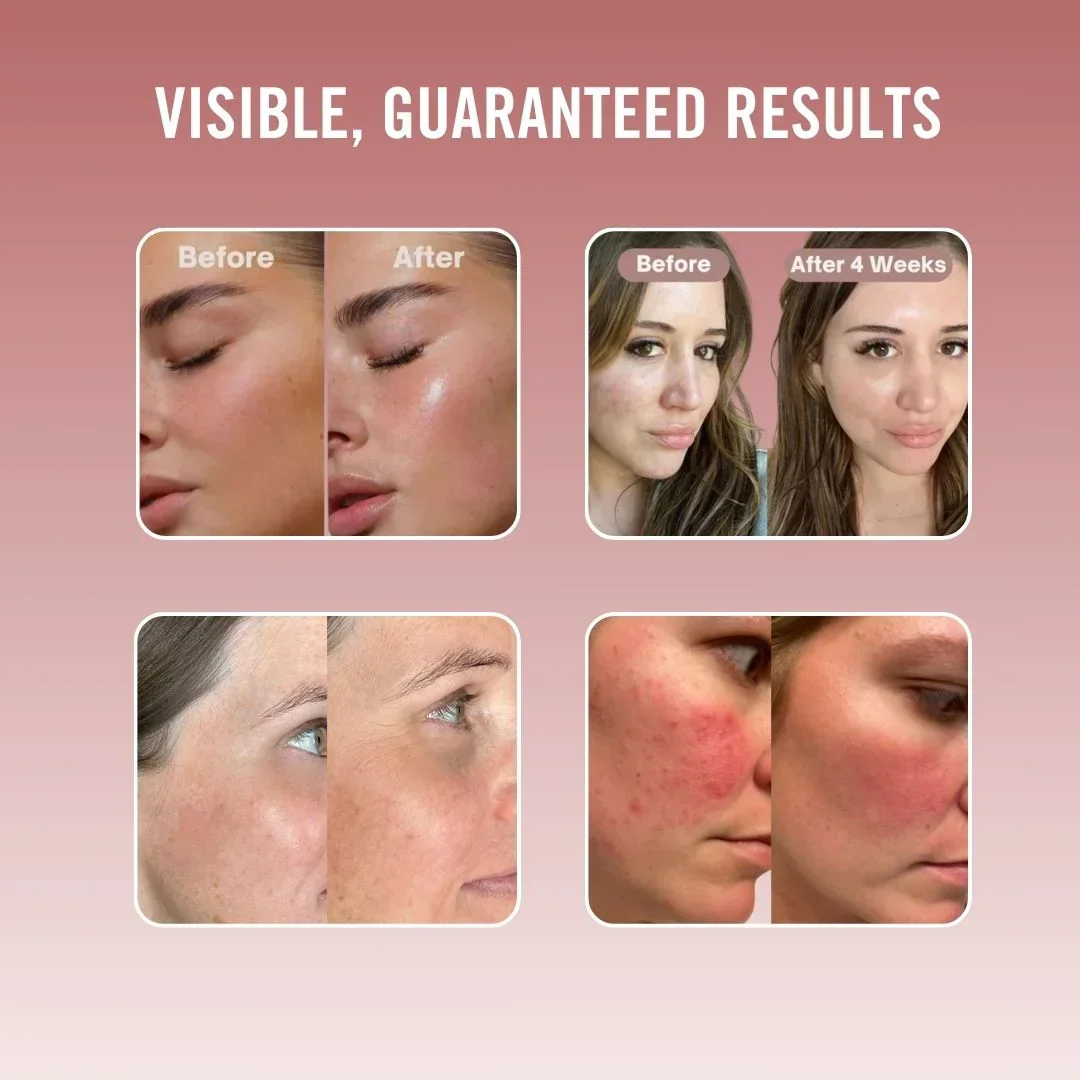Hydrolyzed Collagen Boost 4 Weeks Treatment - Image 4