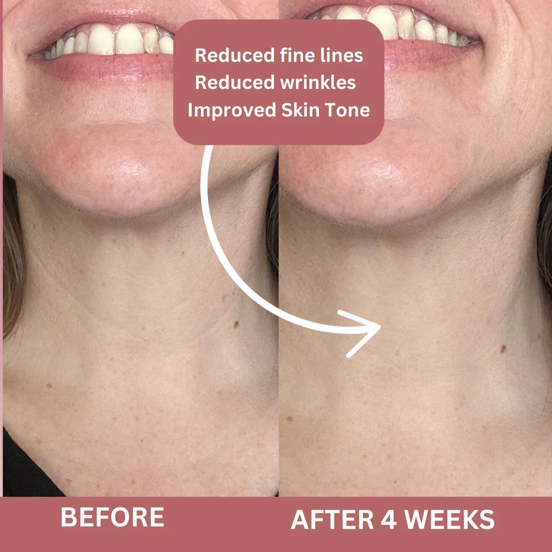 Bio-Collagen Neck Patches - Image 10