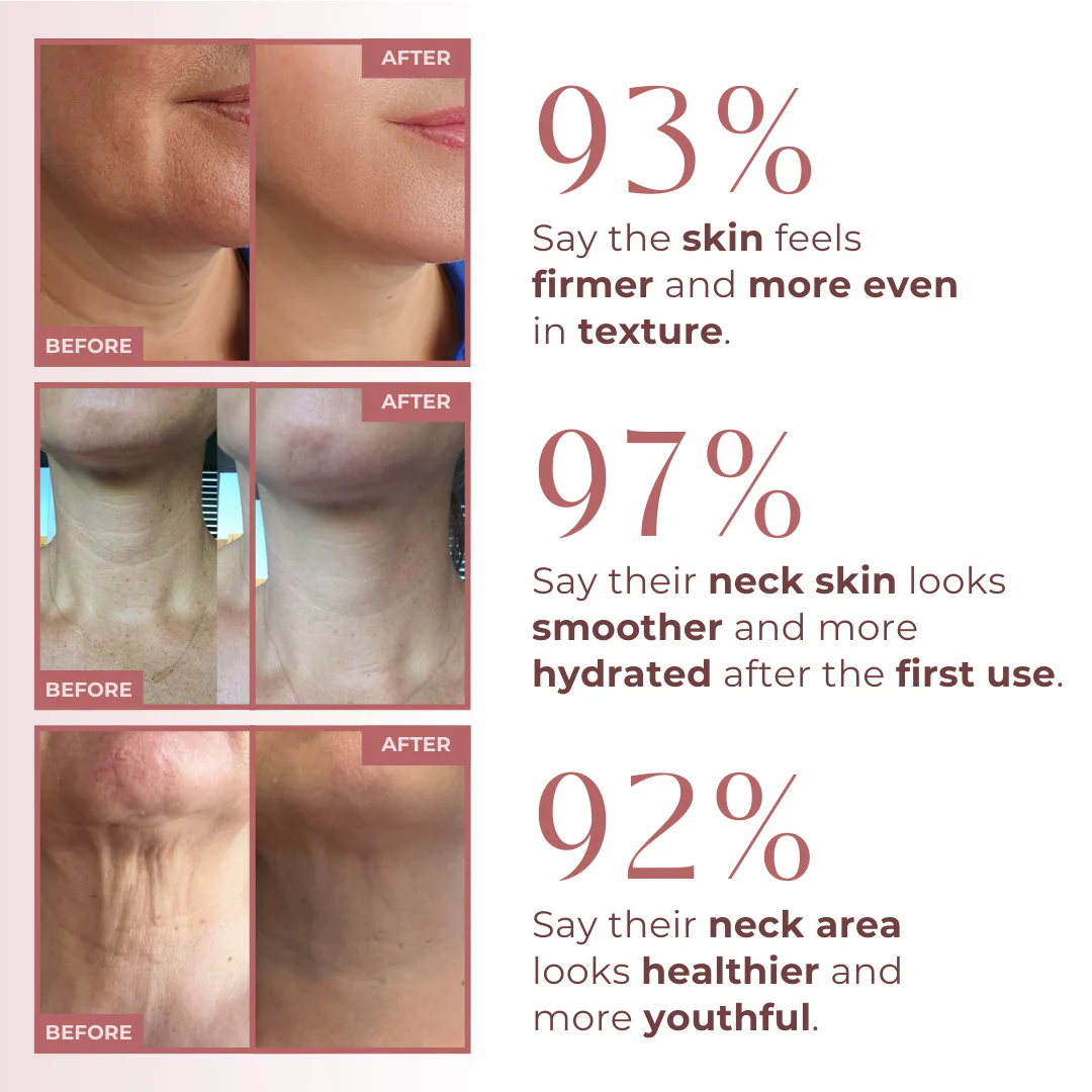 BioCollagen Neck Patches - Image 2