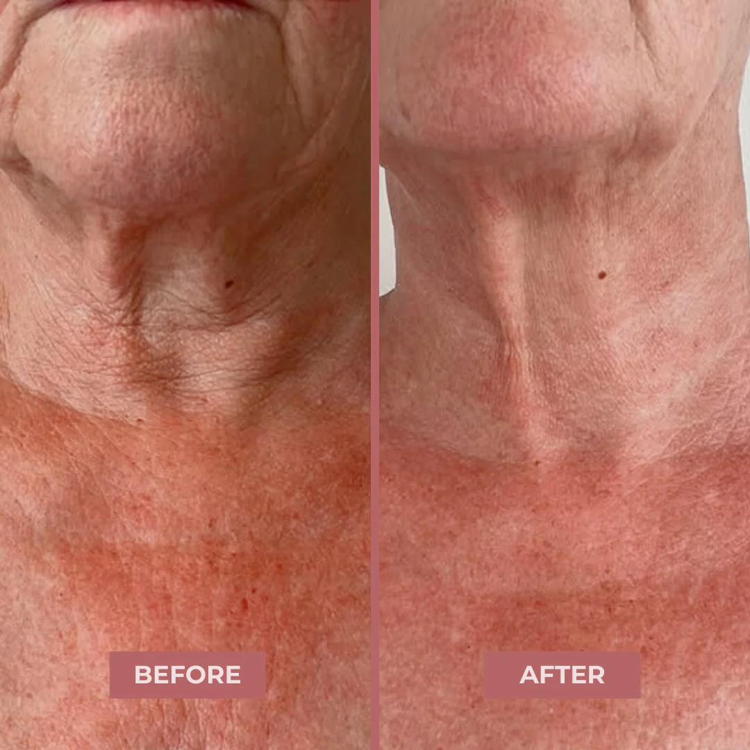 Bio-Collagen Neck Patches - Image 7