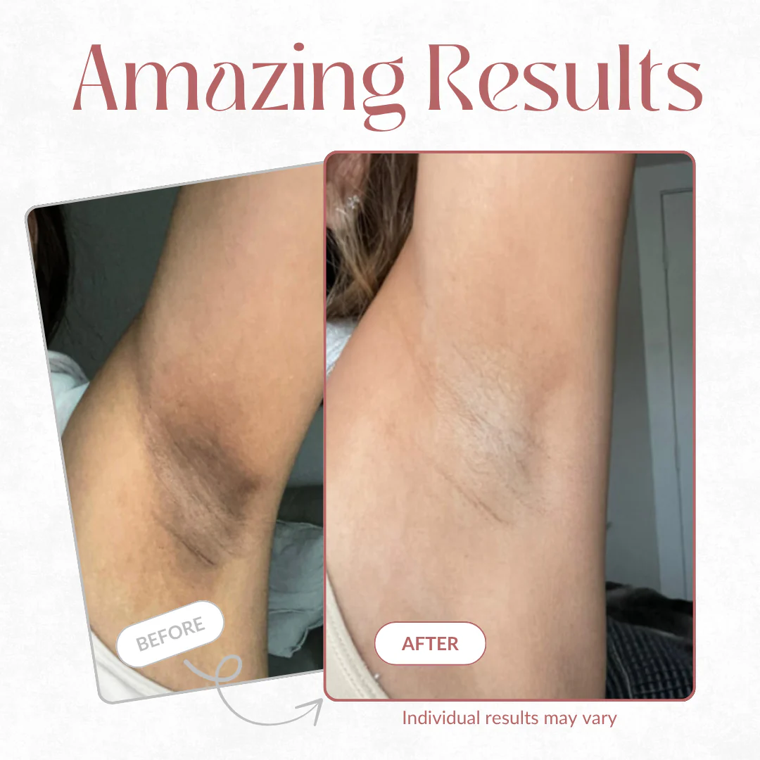 Body Peel Spray - Kojic + Turmeric - Image 9