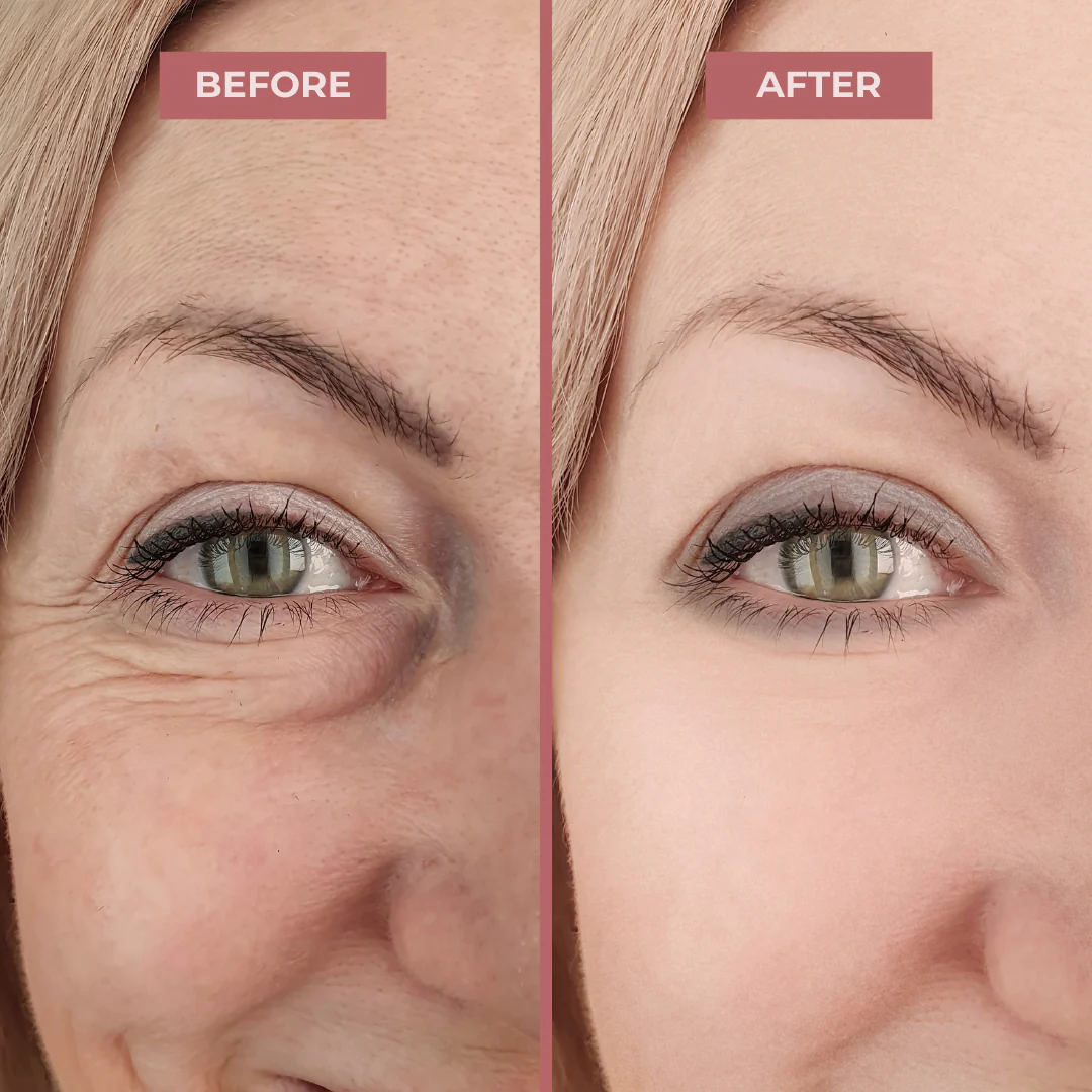 InstantFirm Collagen Eye Patches - Image 7