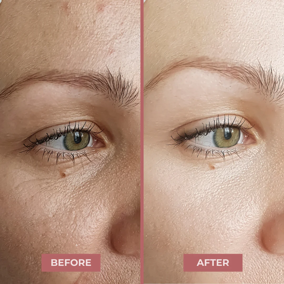Hyaluronic Acid Serum - Image 7