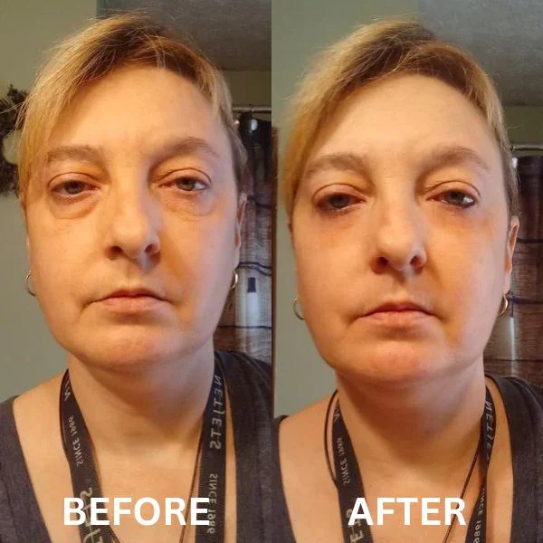 InstantFirm Collagen Eye Patches - Image 11