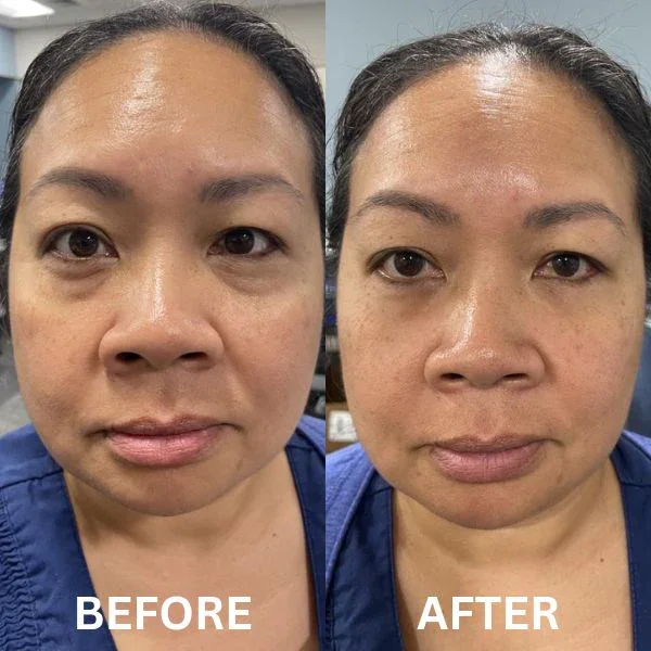 InstantFirm Collagen Eye Patches - Image 10