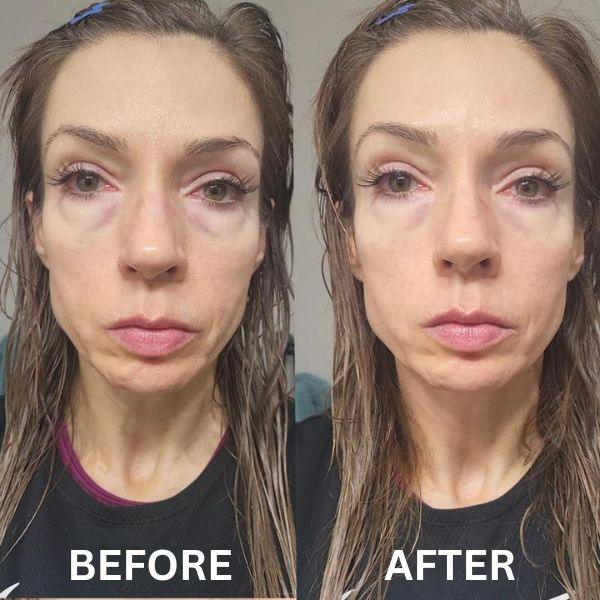 InstantFirm Collagen Eye Patches - Image 12