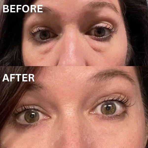 InstantFirm Collagen Eye Patches - Image 9