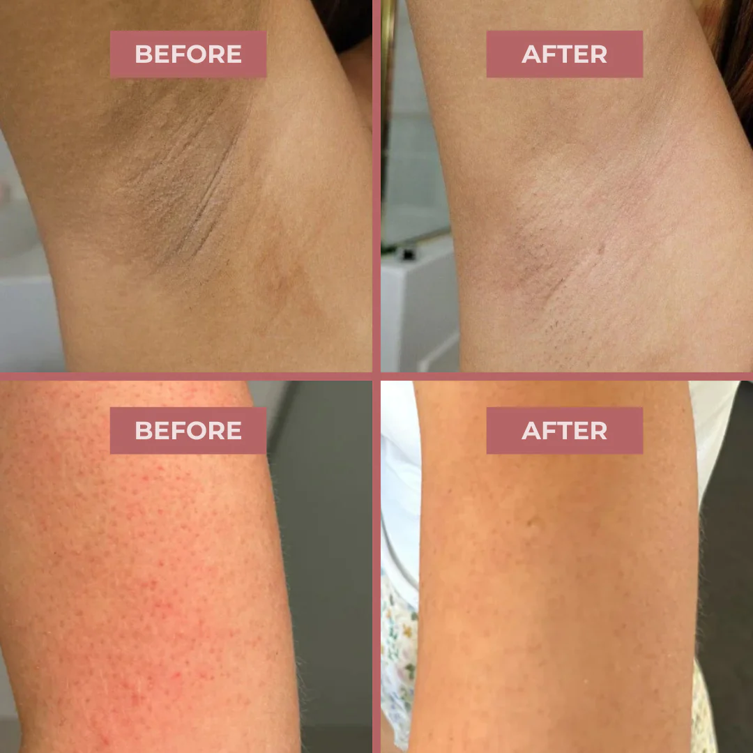 CocoBeauty Peel Shot - Kojic + Turmeric Body Peel Spray - Image 7