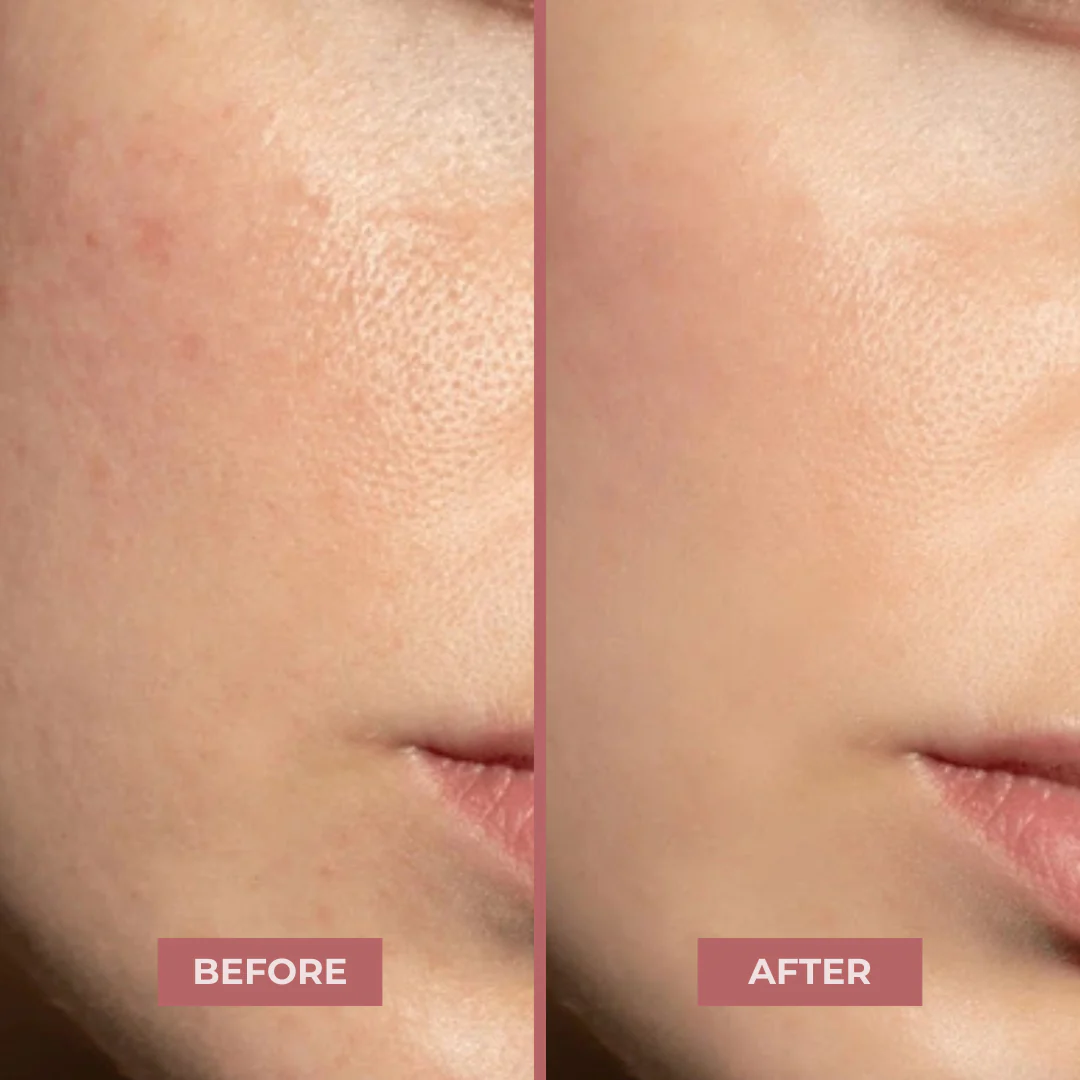 Matcha Calming Mask - Image 7