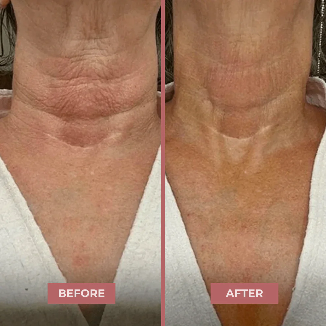 Neck Sculpt Firming Cream – Tighten, Lift & Restore Youthful Skin - Image 7